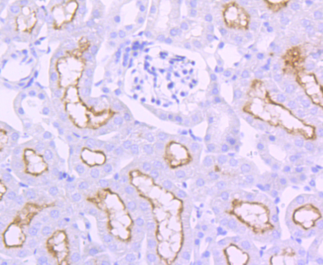 ACE Rabbit mAb