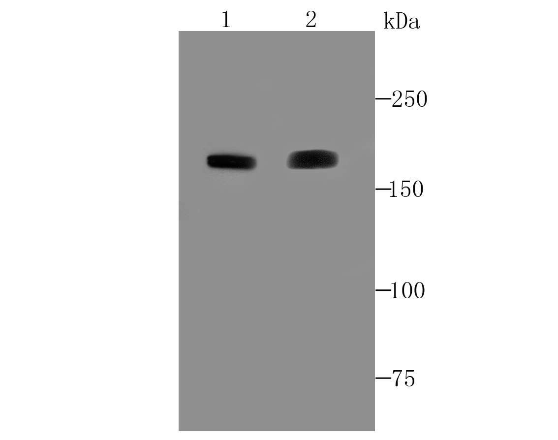 ACE Rabbit mAb