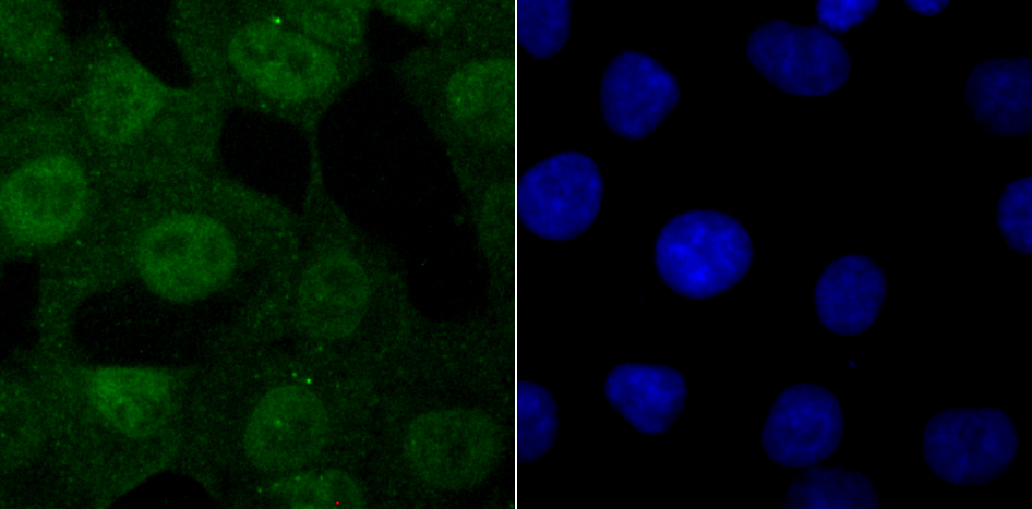 USP11 Rabbit mAb