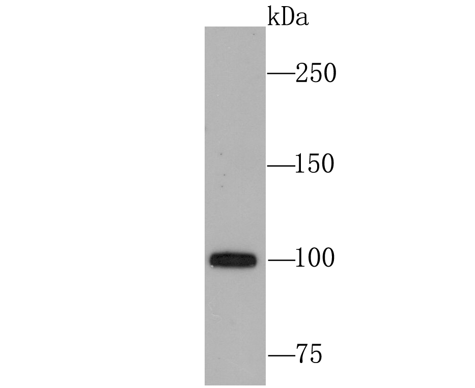 USP11 Rabbit mAb