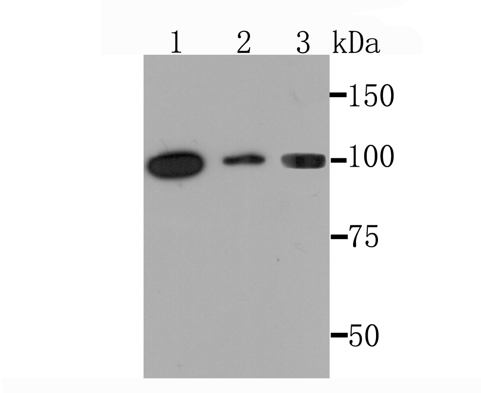 PKC mu Rabbit mAb