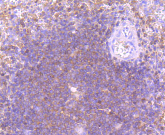 PI 3 Kinase p110 delta Rabbit mAb