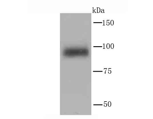 PI 3 Kinase p110 delta Rabbit mAb