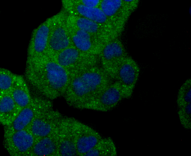 gamma Synuclein Rabbit mAb