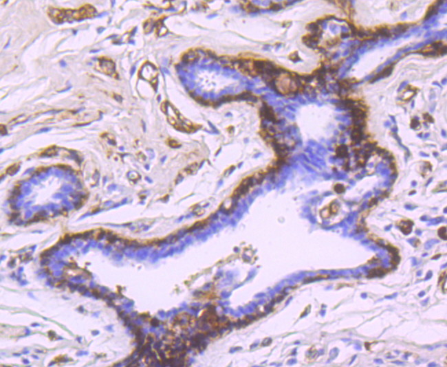 gamma Synuclein Rabbit mAb