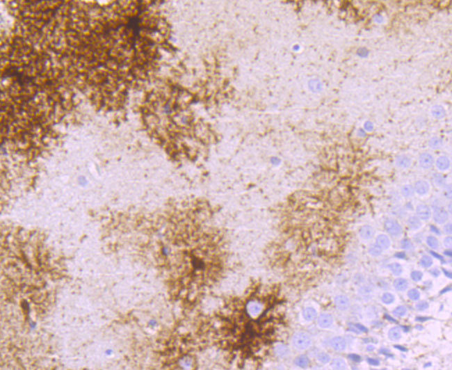 gamma Synuclein Rabbit mAb