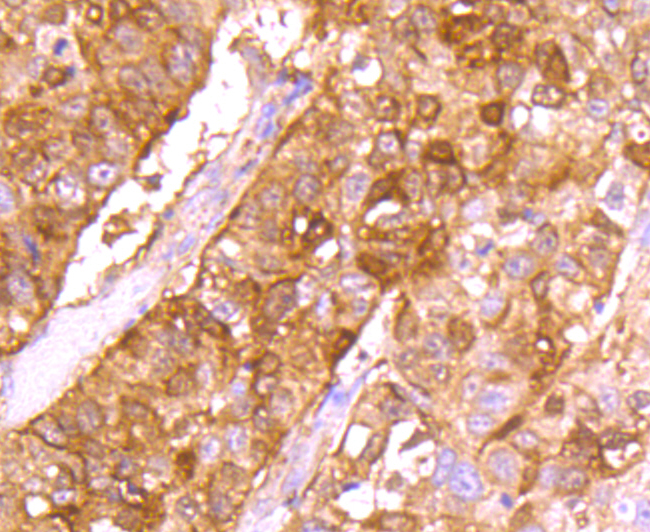 gamma Synuclein Rabbit mAb