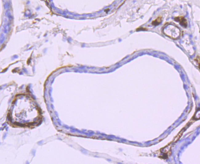 gamma Synuclein Rabbit mAb