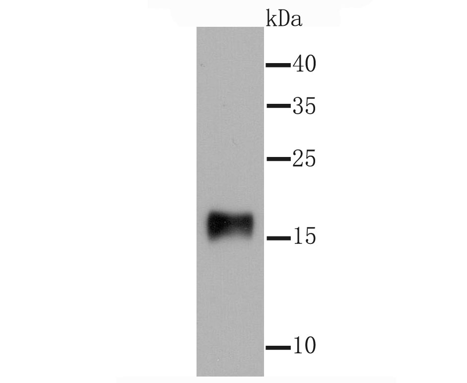 gamma Synuclein Rabbit mAb