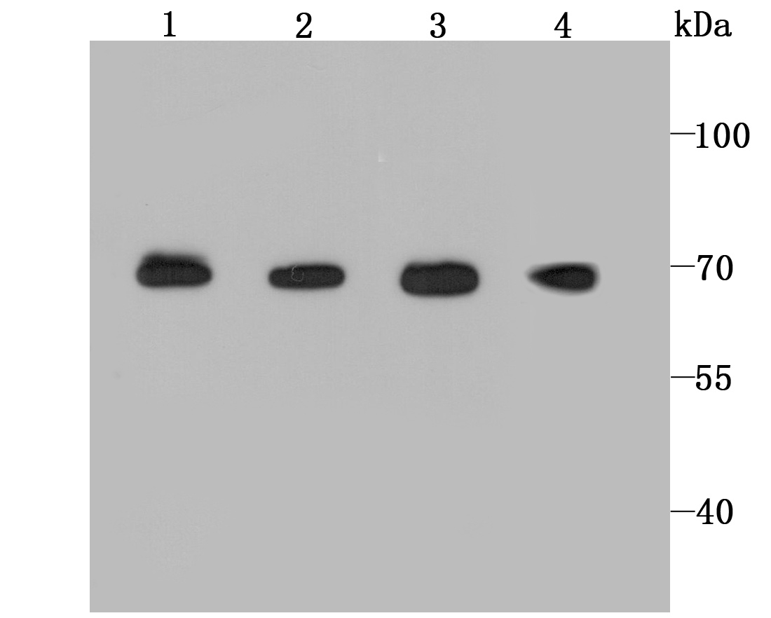 BMAL1 Rabbit mAb