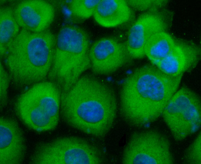 Carcino Embryonic Antigen CEA Rabbit mAb