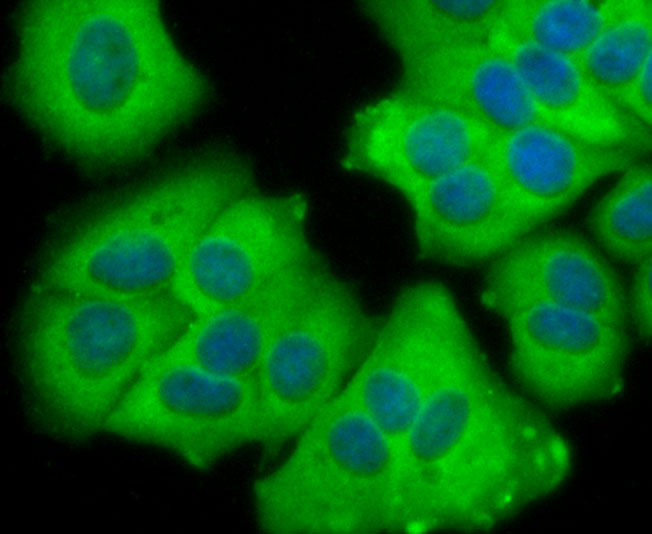 Carcino Embryonic Antigen CEA Rabbit mAb