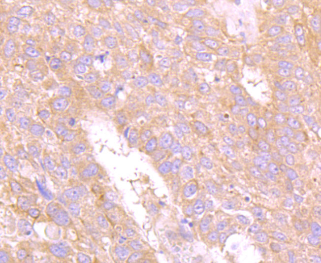 Carcino Embryonic Antigen CEA Rabbit mAb