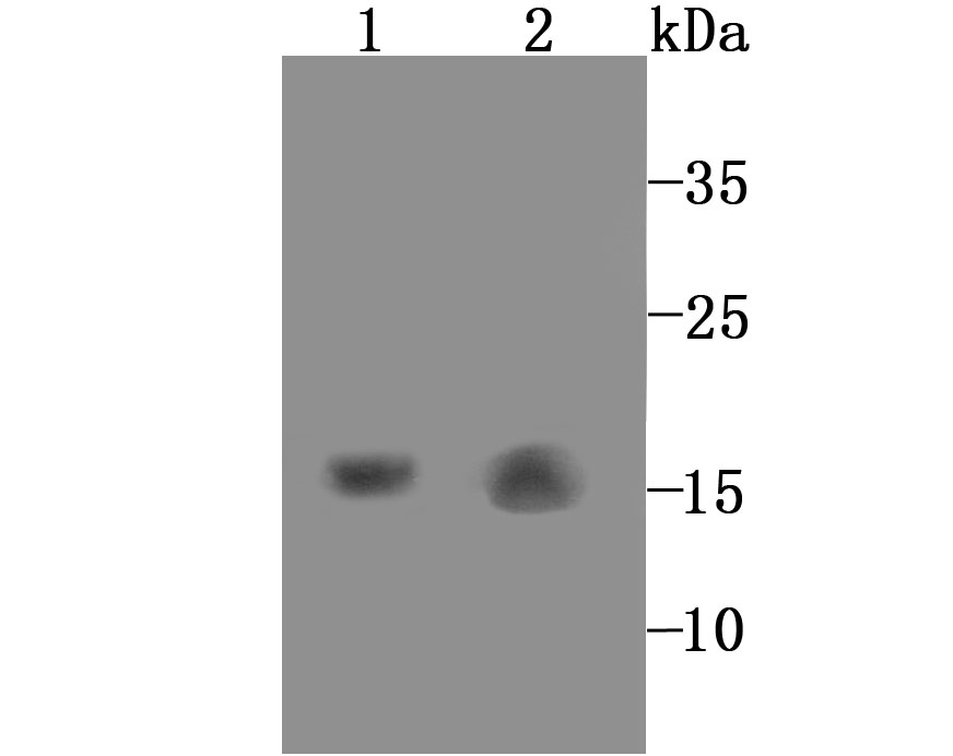 GABARAP Rabbit mAb