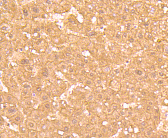 Ferritin Light Chain Rabbit mAb