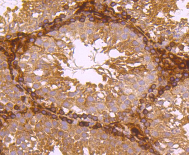 Ferritin Light Chain Rabbit mAb