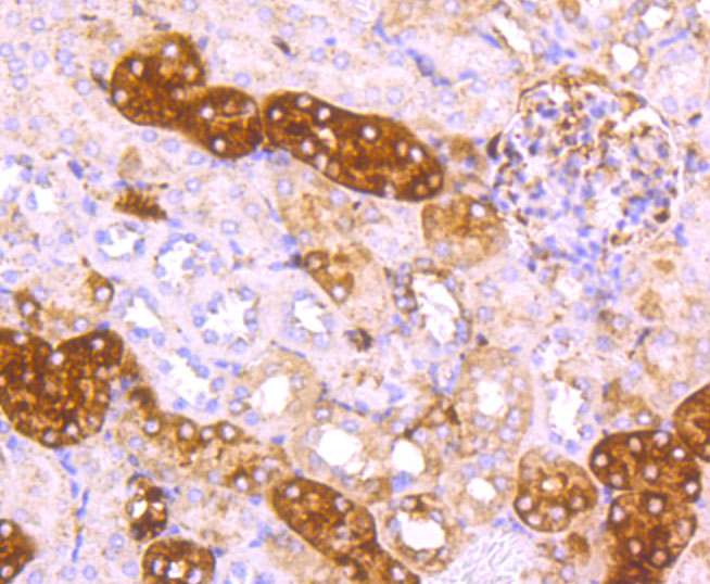 Ferritin Light Chain Rabbit mAb