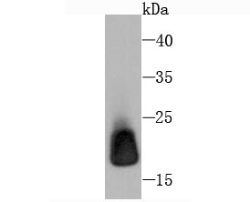 Ferritin Light Chain Rabbit mAb