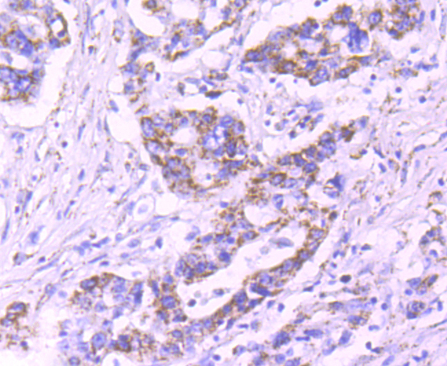 Pyruvate Dehydrogenase E1 beta subunit Rabbit mAb