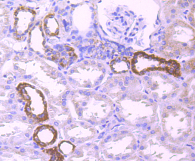 Pyruvate Dehydrogenase E1 beta subunit Rabbit mAb