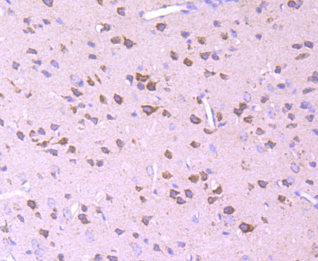 Pyruvate Dehydrogenase E1 beta subunit Rabbit mAb