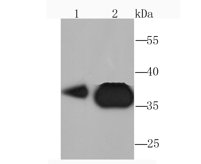 Pyruvate Dehydrogenase E1 beta subunit Rabbit mAb