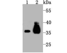 Pyruvate Dehydrogenase E1 beta subunit Rabbit mAb