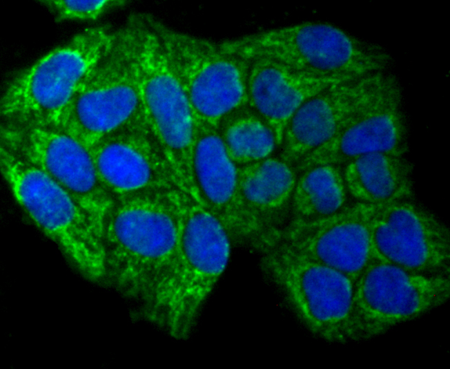 SMYD3 Rabbit mAb