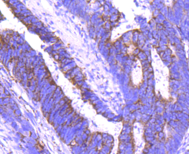 Angiopoietin 2 Rabbit mAb