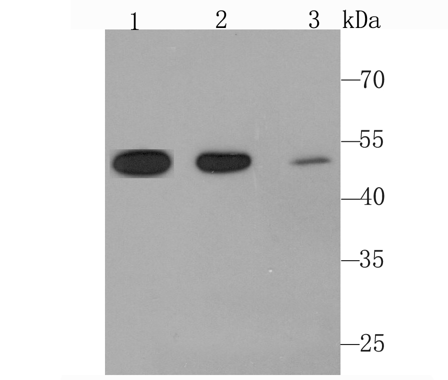 Angiopoietin 2 Rabbit mAb