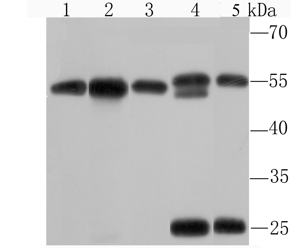 KPNA2 Rabbit mAb