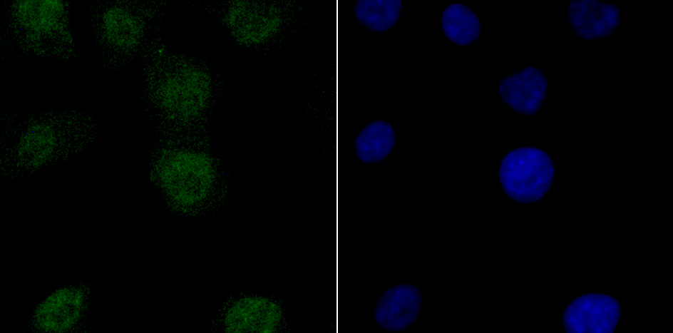 PFKFB3 Rabbit mAb