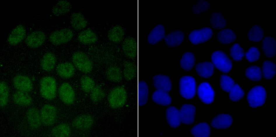 PFKFB3 Rabbit mAb