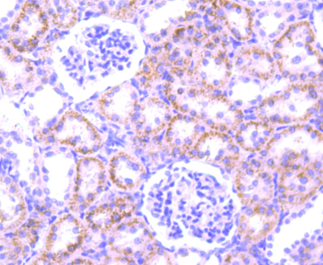 PFKFB3 Rabbit mAb