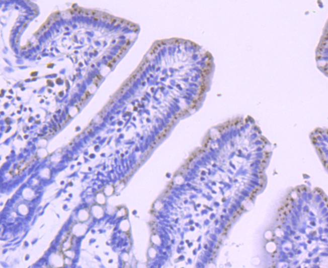 PFKFB3 Rabbit mAb