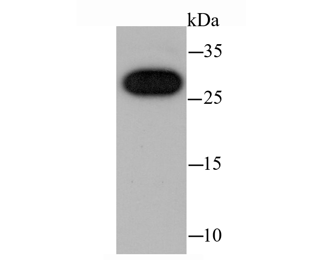 cbx7 Rabbit mAb