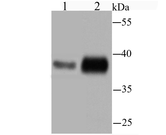 TMEM173 Rabbit mAb