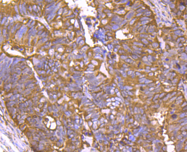 Cyclophilin F Rabbit mAb