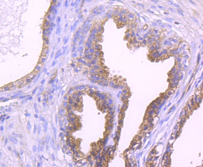 Epac1 Rabbit mAb