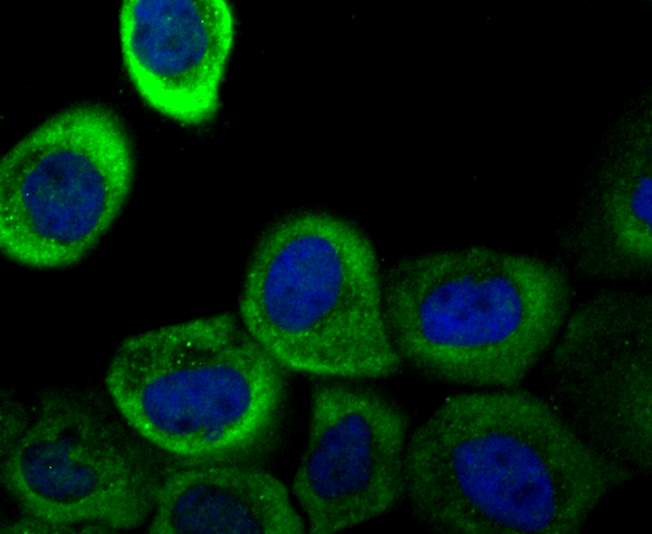 Galectin 1 Rabbit mAb