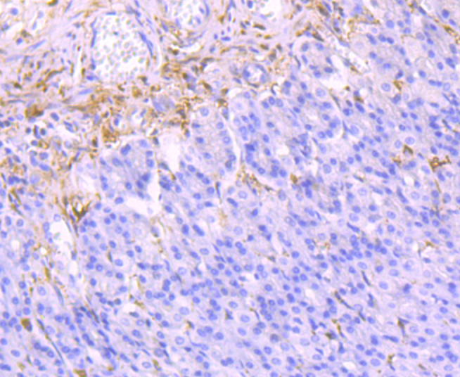 Galectin 1 Rabbit mAb