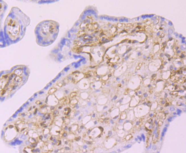 Galectin 1 Rabbit mAb