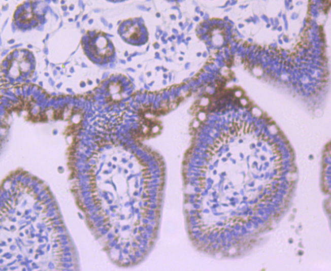 JAK1 Rabbit mAb