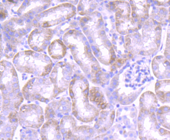 JAK1 Rabbit mAb