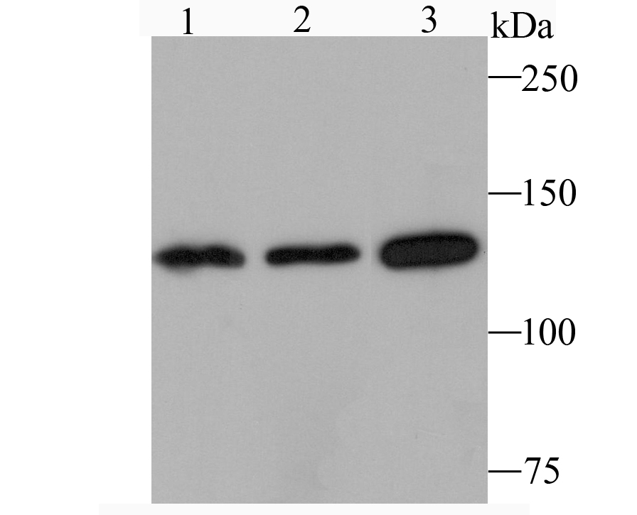 JAK1 Rabbit mAb