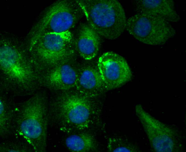 Estrogen Inducible Protein pS2 Rabbit mAb