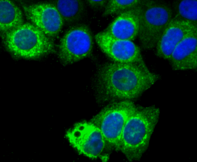 Estrogen Inducible Protein pS2 Rabbit mAb