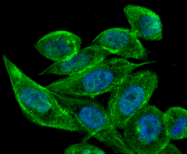 Estrogen Inducible Protein pS2 Rabbit mAb