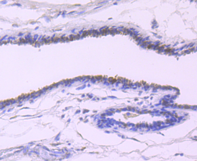 Estrogen Inducible Protein pS2 Rabbit mAb