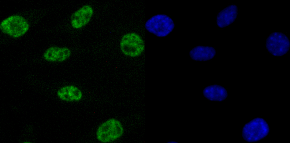 NRF1 Rabbit mAb